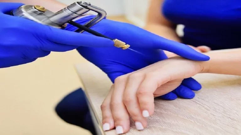 Criocirurgia: Método eficaz no tratamento de lesões da pele