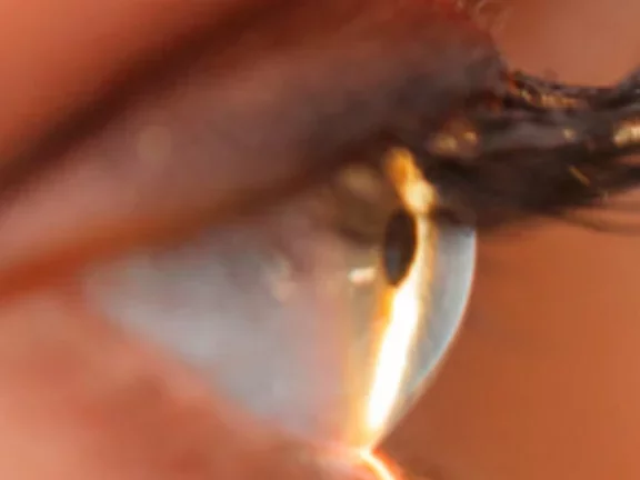 Soluções da Air Liquide para a oftalmologia