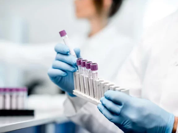 A importância de cuidar de amostras biológicas