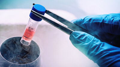 Projeto e Instalação de Rede para Criopreservação