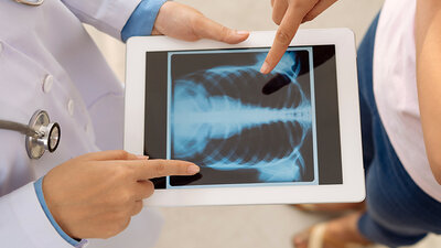 Hipertensão Pulmonar