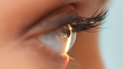 Misturas para Excimer Laser