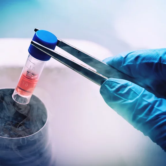 Projeto e Instalação de Rede para Criopreservação