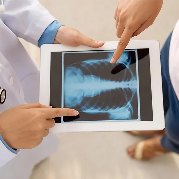 Hipertensão Pulmonar