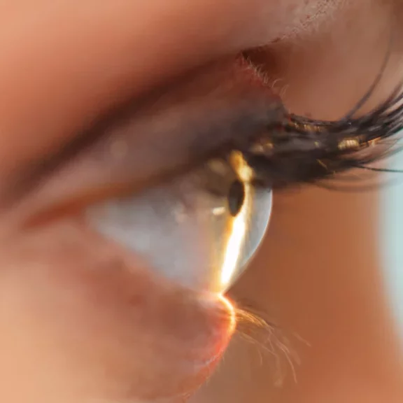 Misturas para Excimer Laser